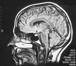 Functional Magnetic Resonance Imaging (FMRI)